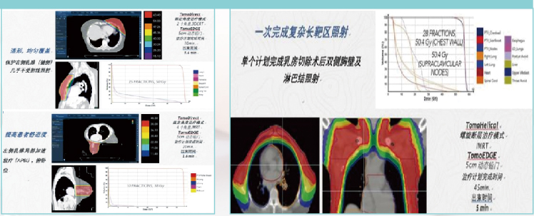 俯臥位乳腺定位墊